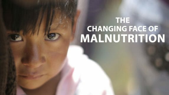 The changing face of malnutrition